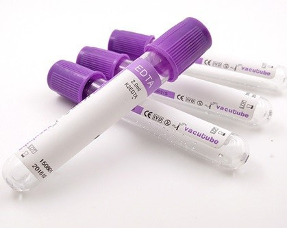 ऊंचाई के अनुसार ब्लड टेस्ट वैक्यूम के लिए JINGZ 0.5ml-10ml K2 EDTA ट्यूब