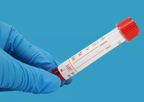 डिस्पोजेबल 10ml वायरस सैंपलिंग किट न्यूक्लिक एसिड एक्सट्रैक्शन किट